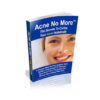 Acne No More