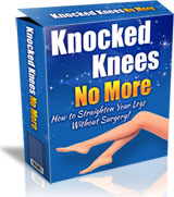 Knocked Knees No More